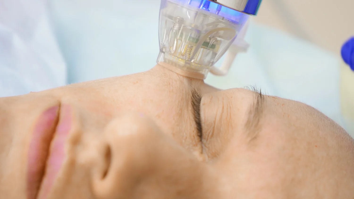 Aesthetician providing a rejuvenating facial treatment to a client in a modern spa clinic setup.