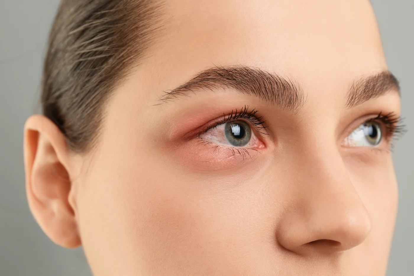 Eyelid Diseases