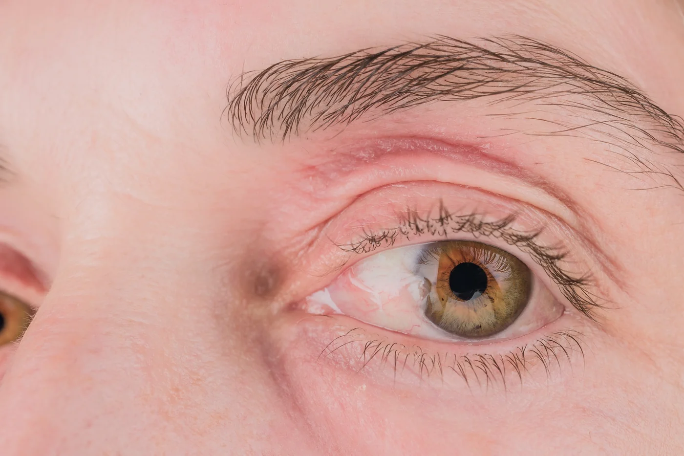 Serious female patient looking at light from contemporary ophthalmic bio microscope while getting eyesight examination in modern clinic during check up